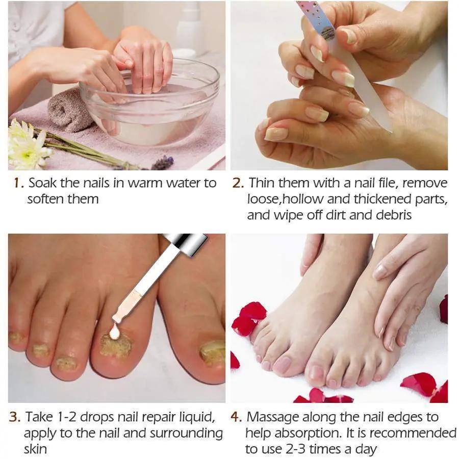 Vibrant Glamour Nail Repair Fluid Hand and Foot Nail Fungus Care Bright Nail by Oz-Direct.com