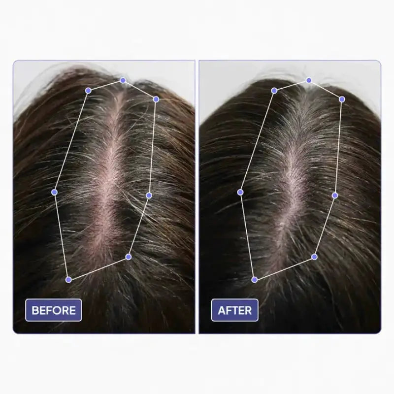 Scalp Hair Growth Oil by Oz-Direct.com
