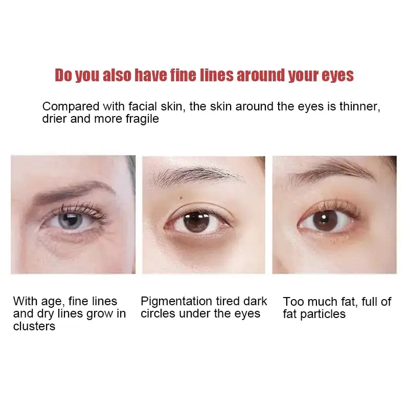 New Anti-Wrinkle Eye Cream by Oz-Direct.com