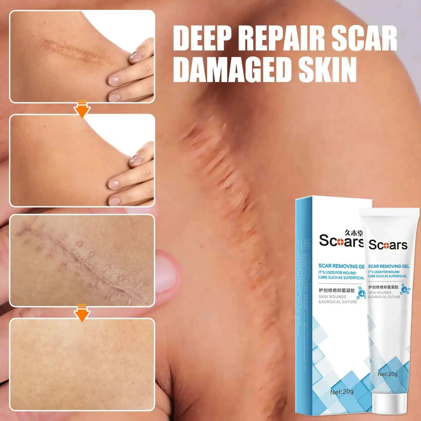 New Herbal Scar Repair Cream by Oz-Direct.com