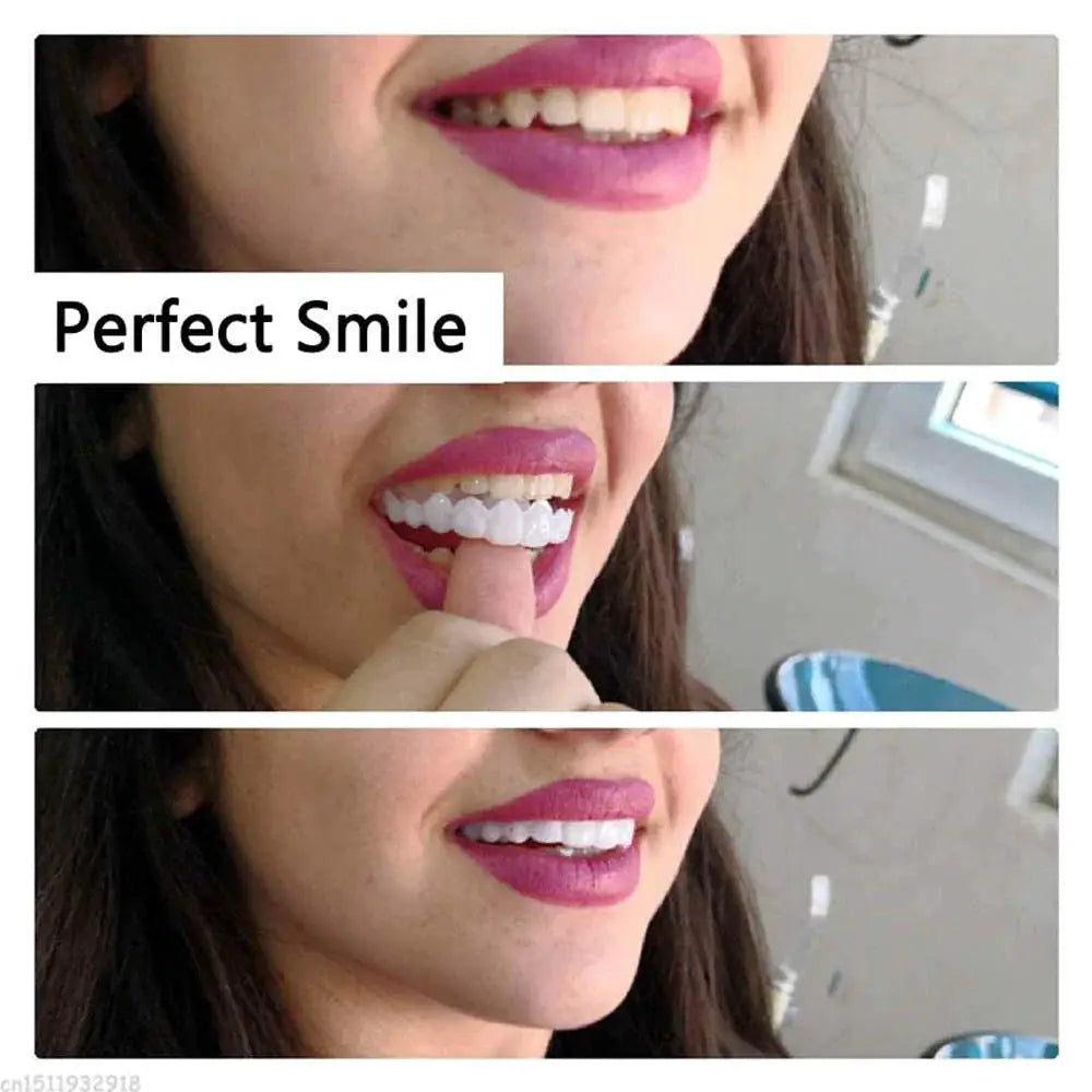 Instant Perfect Smile Dental Veneers by Oz-Direct.com