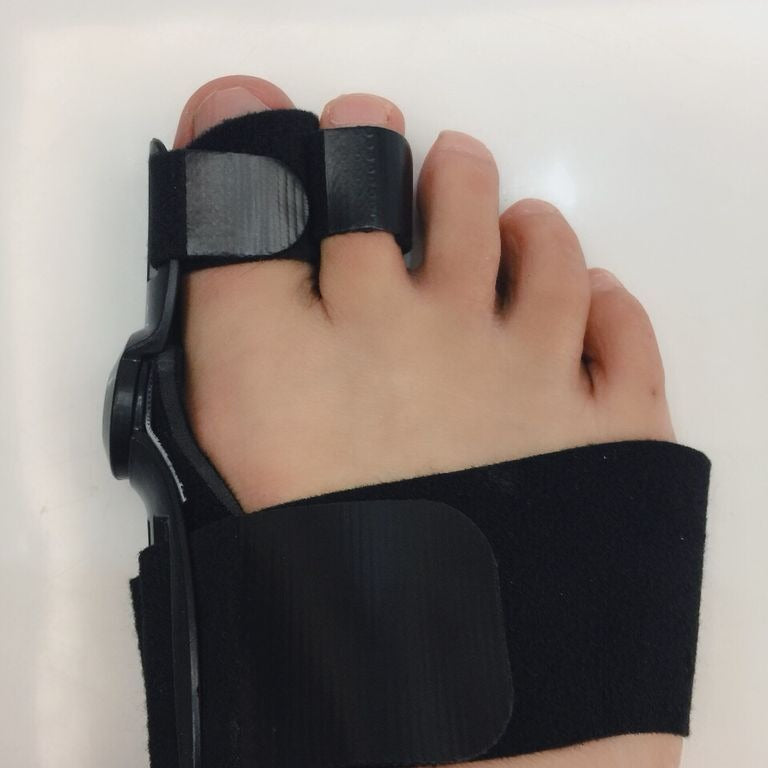 Day And Night Use Of Hallux Valgus Orthosis Thumb Valgus Orthosis Toe Orthosis