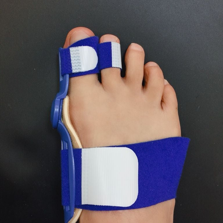 Day And Night Use Of Hallux Valgus Orthosis Thumb Valgus Orthosis Toe Orthosis