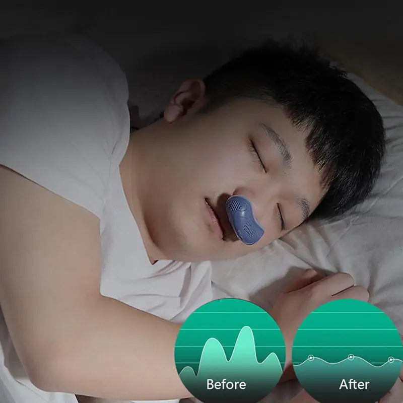 Anti-Snoring Nose Clip Sleep Tray